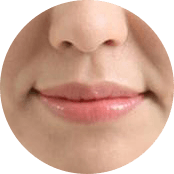 广州肤康皮肤病医院