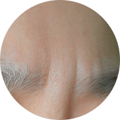 广州肤康皮肤病医院