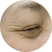 广州肤康皮肤病医院