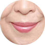 广州肤康皮肤病医院